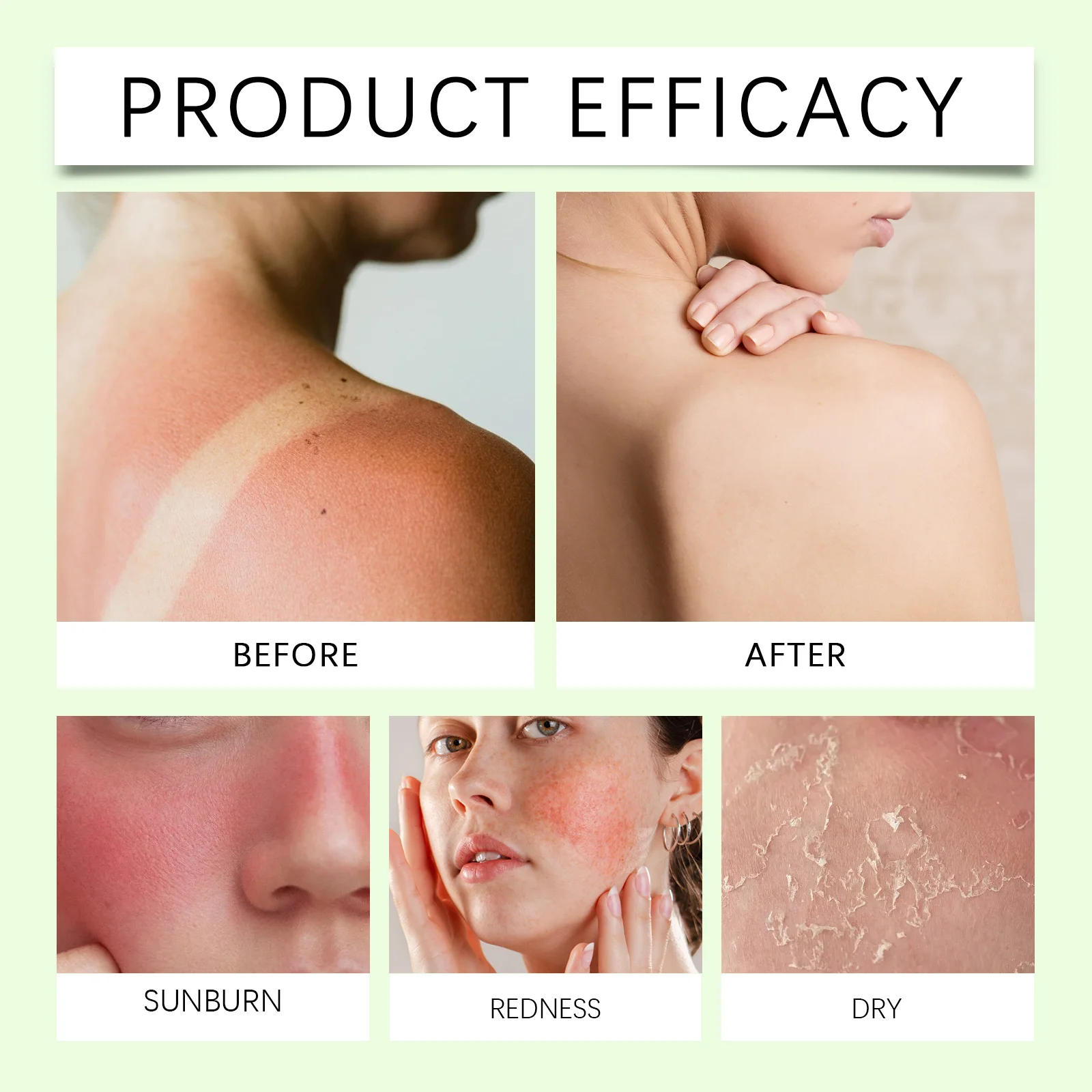 hanchobit aloe soothing gel after sun care moisturizing HANCHOBIT HX 60 725