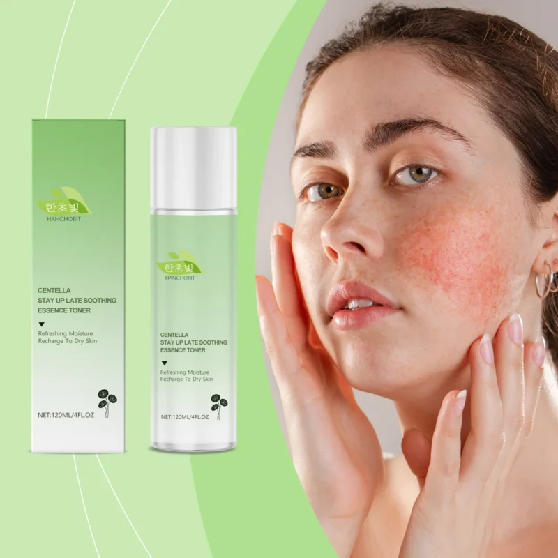 HANCHOBIT Centella Asiatica Soothing Essence for Hydration & Oil Balance - Image 2