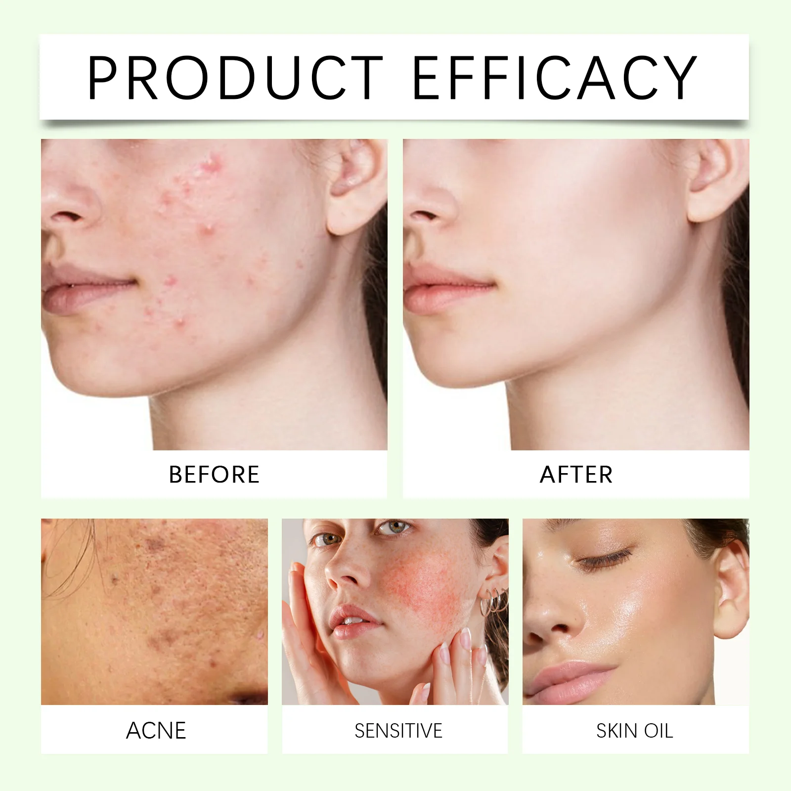 hanchobit centella soothing essence sensitive skin HANCHOBIT HX 52 621