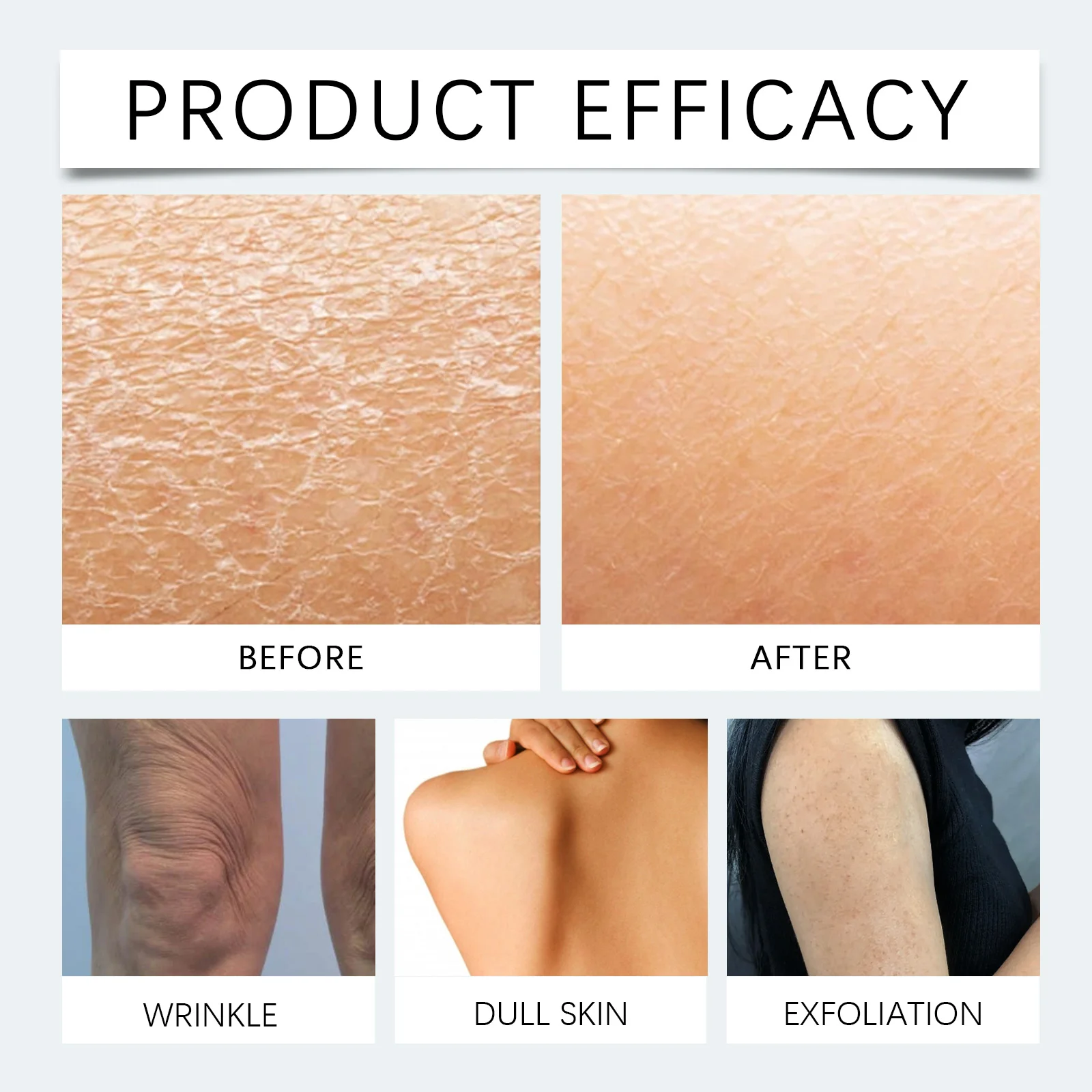 hanchobit ceramide cream moisturizes protects skin barrier HANCHOBIT HX 30 353