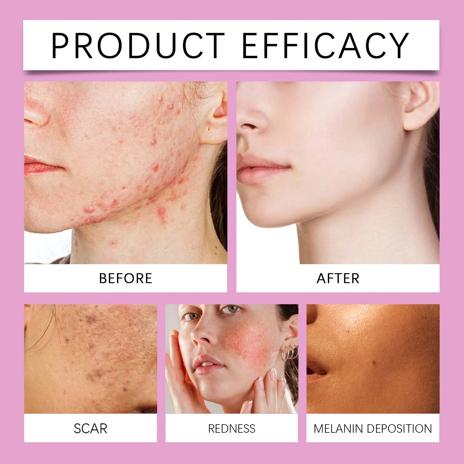 hanchobit moisturizing essence facial balance delicate pores HANCHOBIT HX 25 298