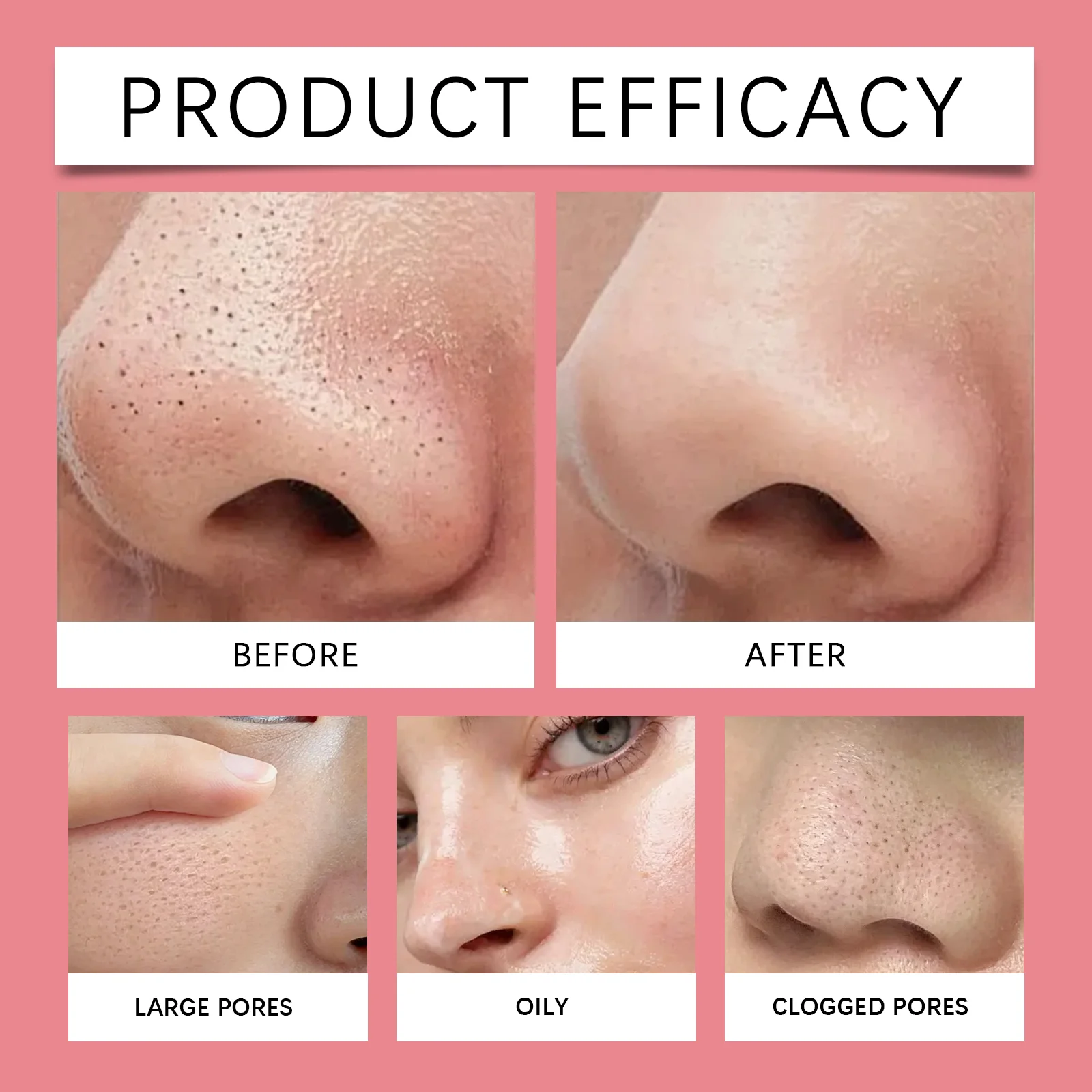 hanchobit pomegranate blackhead nose mask HANCHOBIT HX 95 1181